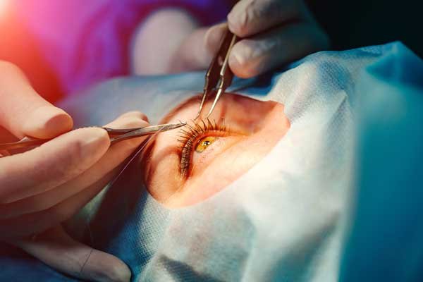 lasik-surgery-huntington-ny